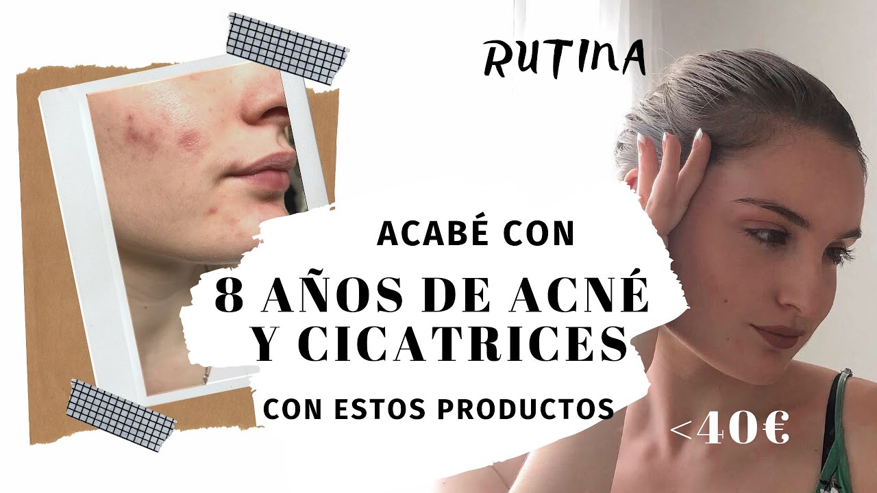 Adiós a la piel grasa: rutina de skincare con The Ordinary