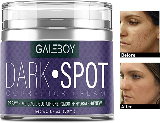 Ambi Skincare Fade Cream: Desvanece manchas y unifica el tono de piel