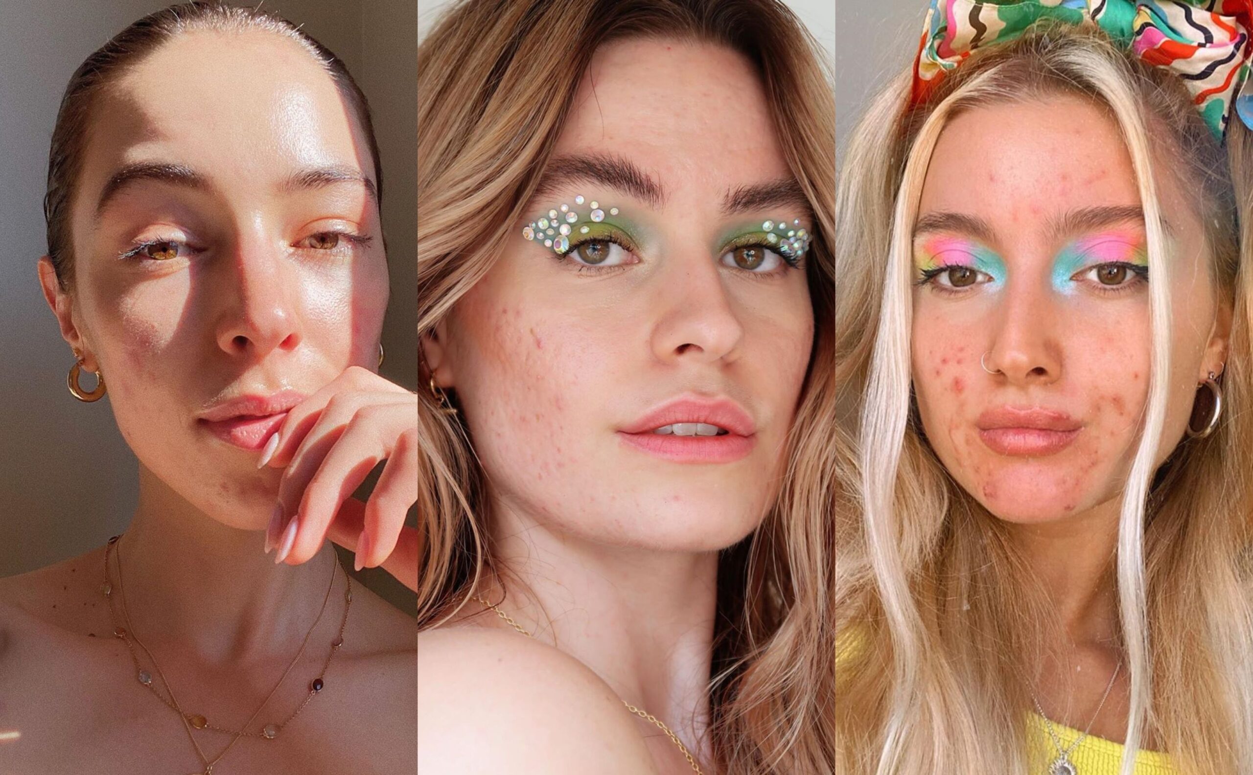 Mejores consejos de maquillaje para Bellezaes con acné
