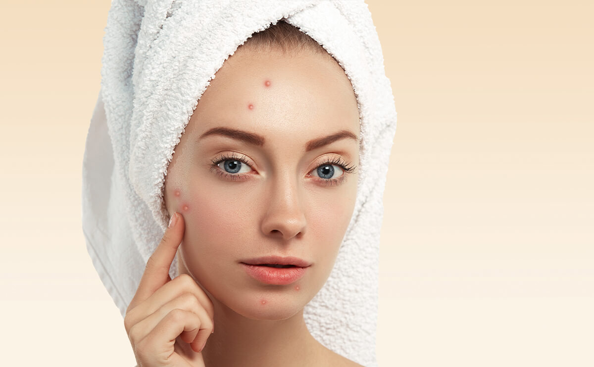 Descubre el mejor maquillaje para Belleza acne: cobertura perfecta y cuidado de la Belleza