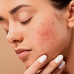 Descubre un maquillaje no comedogénico: ¡Belleza perfecta sin obstruir tus poros!
