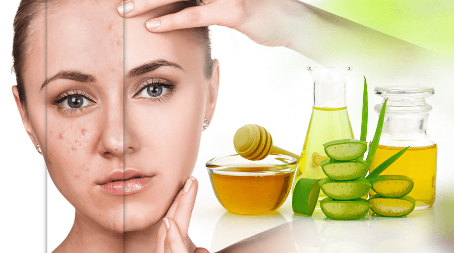 Clínica de acné y cuidado natural de la piel