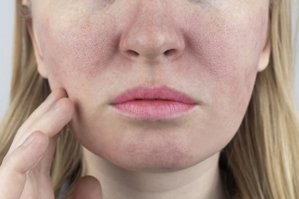 Conoce los mejores tips skincare para una piel radiante