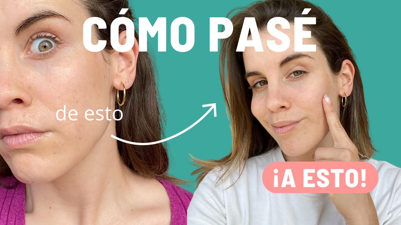 Consigue una piel radiante con nuestra rutina de skincare casera