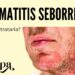 Controla la dermatitis seborreica con nuestra rutina de skincare