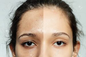 Descubre si el maquillaje Asepxia realmente funciona