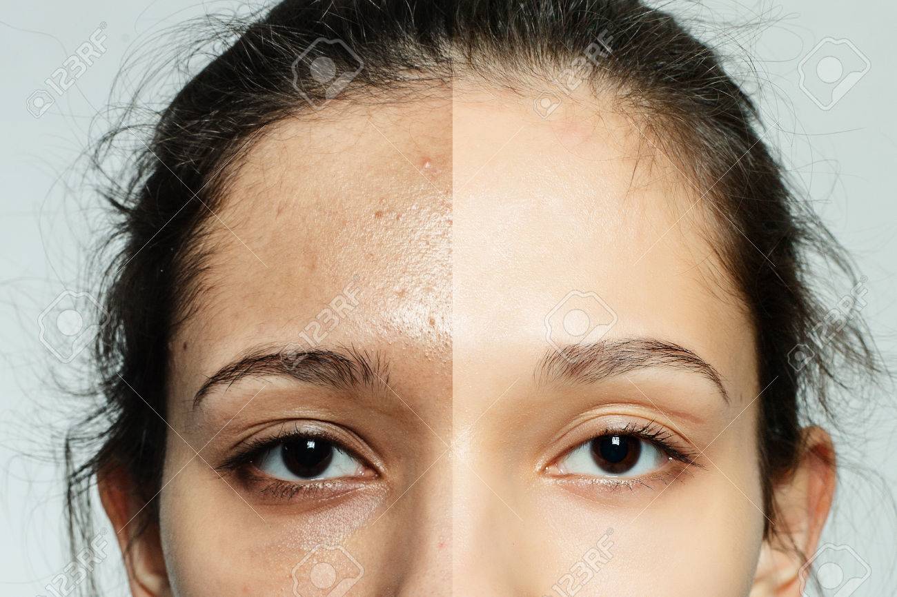 Descubre si el maquillaje Asepxia realmente funciona