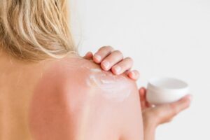 Consejos para el cuidado de la piel quemada por el sol: alivio y prevención