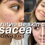 Cuidado antienvejecimiento para piel con rosácea