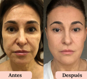 Cuidado facial: ¿antes o después del ejercicio?