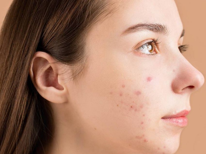 Descubre la magia de la piel con skincare herbal