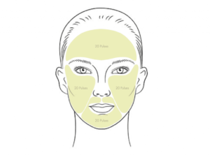 Descubre la verdad detrás de Nira Skincare Laser: Reseñas y Opiniones