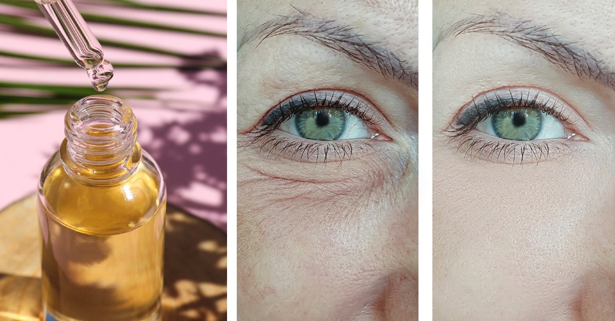 Descubre qué usar para tu rutina de skincare y luce una piel radiante