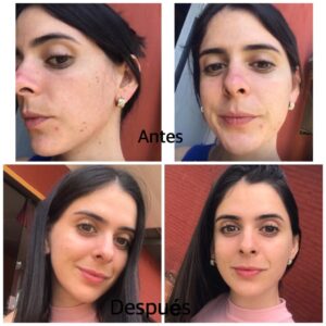 Descubre tu mejor piel con nuestra caja de skincare