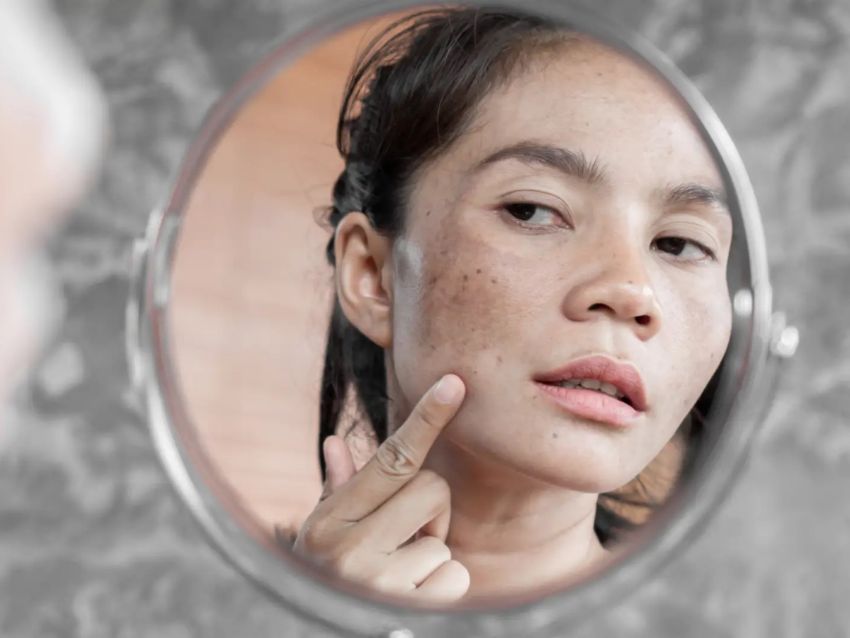 Desenmascarando los productos para el cuidado de la piel