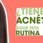 Despídete del acné con estos tips de skincare