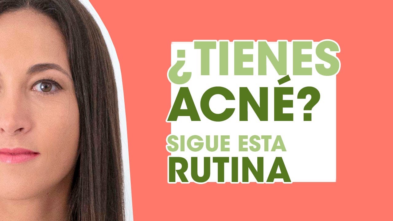 Despídete del acné con estos tips de skincare