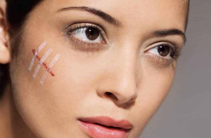 Desvanece cicatrices con cuidado facial japonés