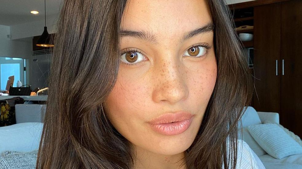 Elimina el acné hormonal con nuestro skincare