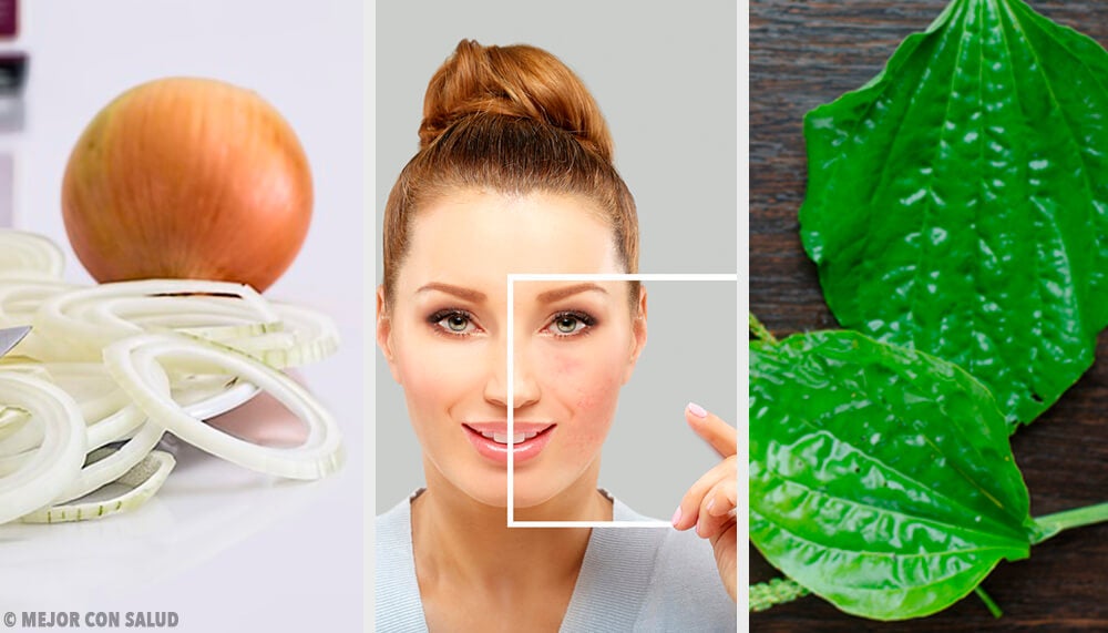 Elimina manchas oscuras con ingredientes para el cuidado de la piel