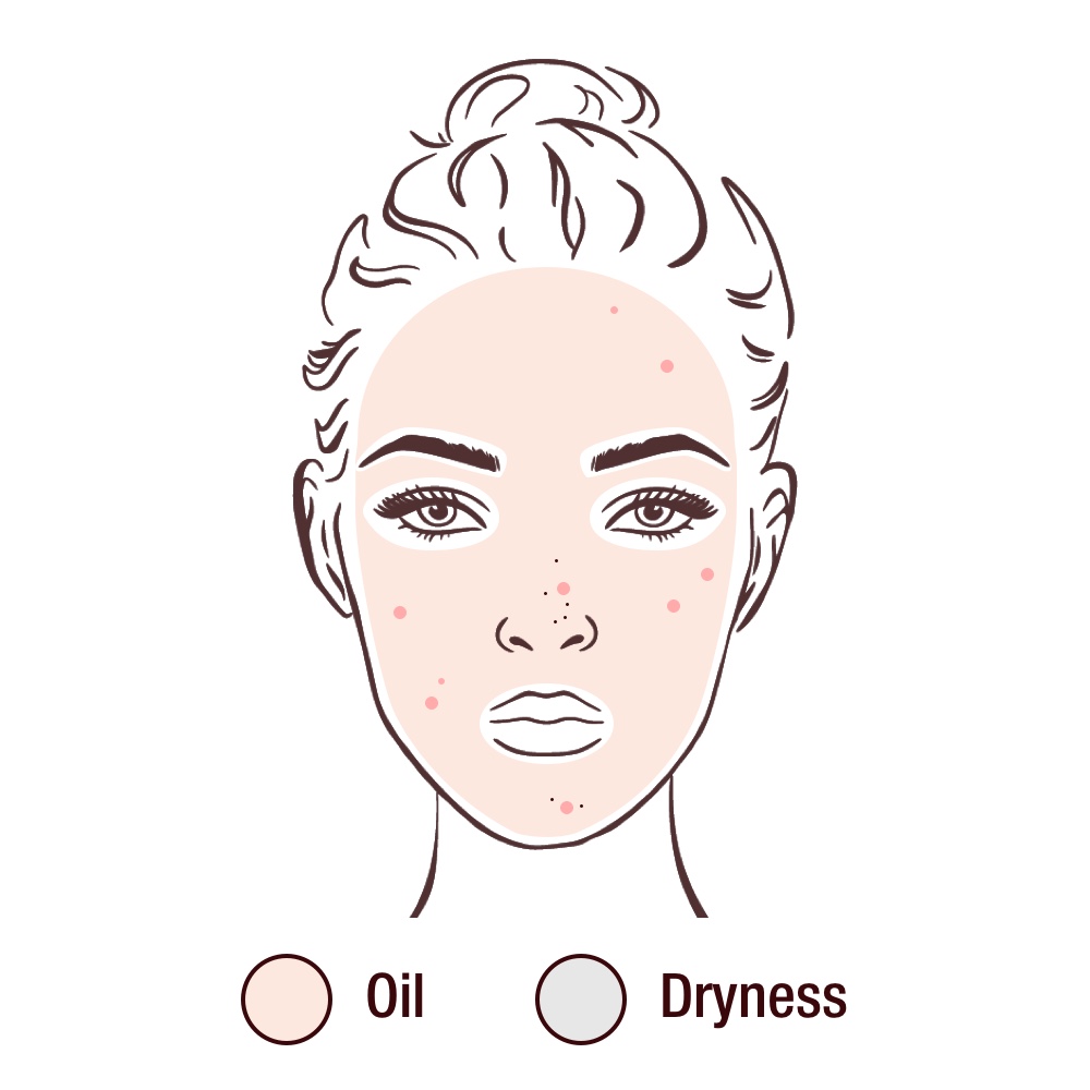 Equilibra tu piel grasa con nuestra rutina de orden skincare