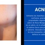 Guía de cuidado de piel coreano: secretos para una piel radiante