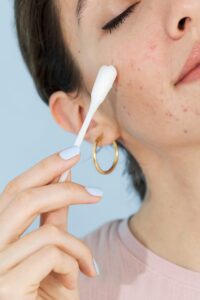 La mejor skincare coreana para el acné: ¡adiós a los granitos!