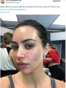 La revolución de la piel: descubre cómo Kim Kardashian cuida su cutis