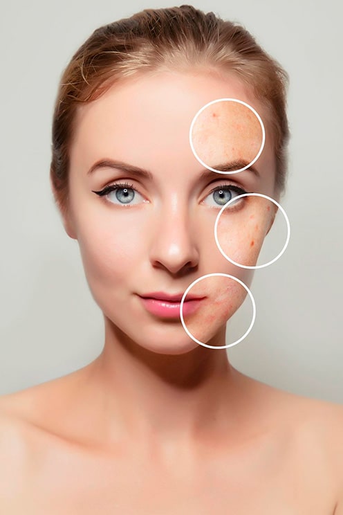 Logra una piel radiante con nuestro tratamiento skincare