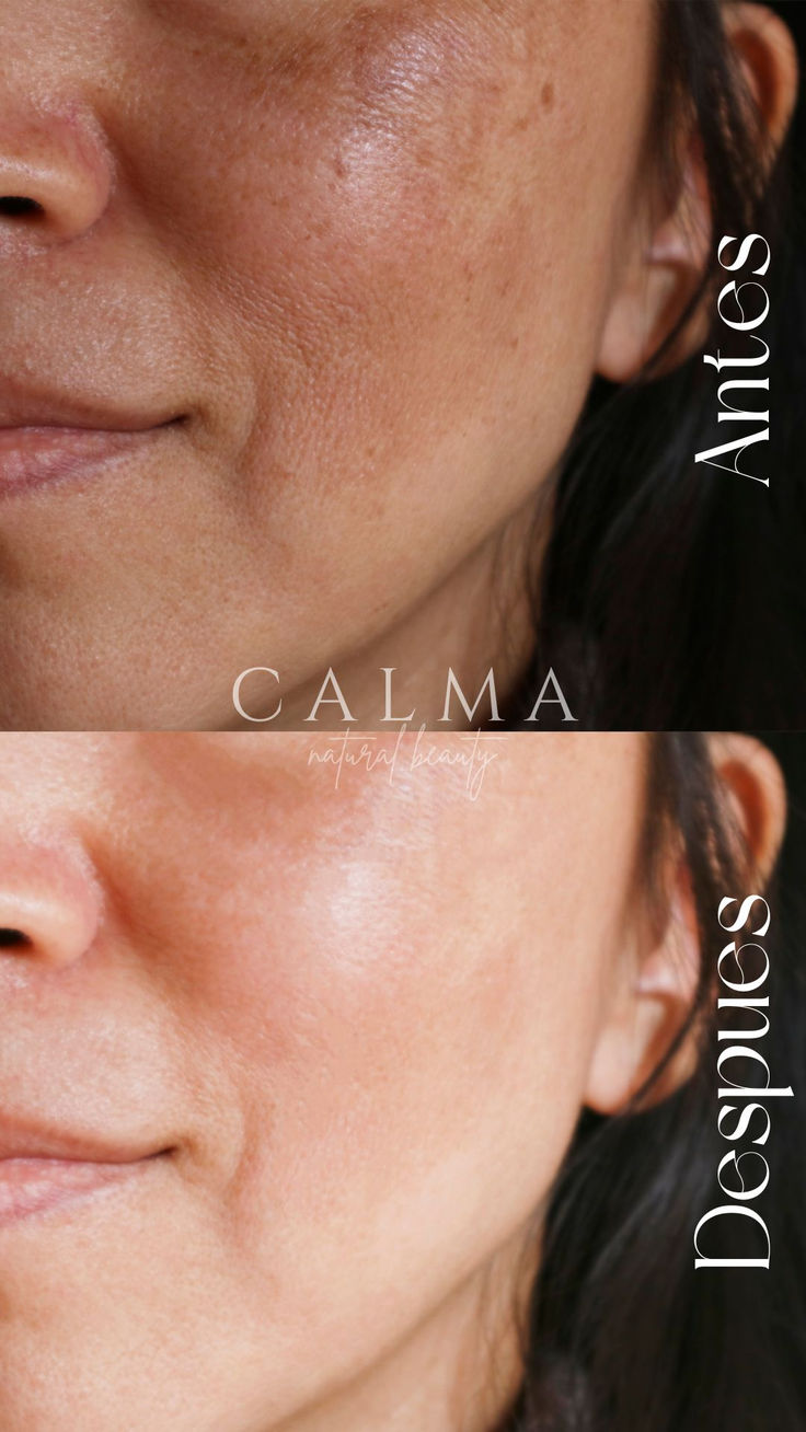 Logra una piel radiante con nuestros skincare goals