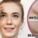 Logra una piel radiante con skincare y retinol: consejos y productos