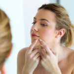 Logra una piel radiante: Skincare para piel con acné
