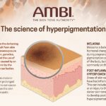 Logra una piel uniforme con Ambi Skincare Fade Cream: Guía de uso