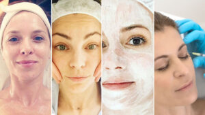 Secretos de belleza en casa: cuidado de la piel con tratamientos naturales