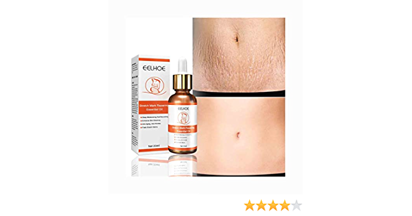 Obtén una piel radiante con Bio Oil Skincare Oil en Amazon