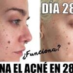 Piel clara y sin imperfecciones con Garnier Pure Active