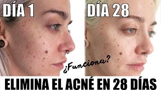 Piel clara y sin imperfecciones con Garnier Pure Active
