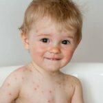 Consejos para los cuidados de la piel en niños de 3 años