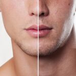 Consejos de cuidado de la piel grasa para hombres: mantén tu rostro fresco y sin brillo.