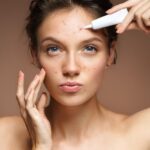 Rutina de cuidado facial para piel grasa y con acné: Tips y productos recomendados