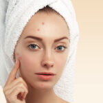 Rutina de cuidado facial para el acné con The Ordinary: consejos y productos recomendados