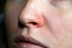 Los mejores cuidados para la piel seca del rostro: tips y consejos útiles