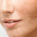 Elimina las manchas de tu piel con esta efectiva rutina de skincare