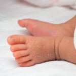 Consejos esenciales para el cuidado de la piel delicada del recién nacido