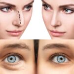 Rejuvenece tu piel con ácido hialurónico, ¡descubre sus beneficios!