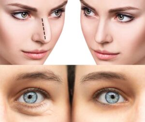 Rejuvenece tu piel con ácido hialurónico, ¡descubre sus beneficios!