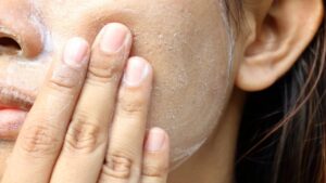 Remedios naturales para cuidado de piel