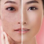 Revitaliza tu piel seca con la rutina de cuidado coreano