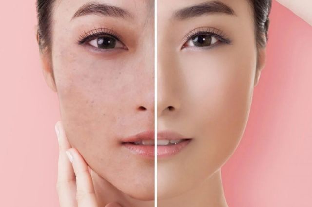 Revitaliza tu piel seca con la rutina de cuidado coreano