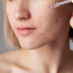 Revive tu piel con la tendencia de skincare de los 90s